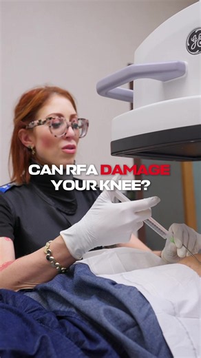 Is there a safer, less invasive alternative to knee replacement? 🦵 Knee RFA is a minimally invasive procedure that can help relieve chronic knee pain without major surgery. It uses controlled heat to interrupt the nerves sending pain signals from your knee. The procedure is generally considered safe when performed by a qualified physician, although risks still exist. For some patients, relief can last several months or longer, making it easier to walk, exercise, and stay active. While it doesn’
