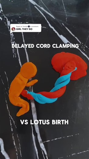 Delayed cord clamping vs lotus birth | lotus