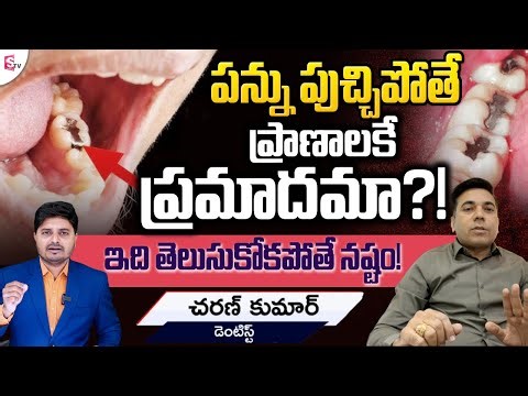 Dentist Explains: Is Tooth Decay Dangerous? | Dr. Charan Kumar | SumanTV Sai