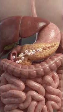 Pearson Syndrome — A Rare Mitochondrial Disorder