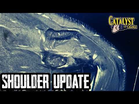Project LUCA - Shoulder Update