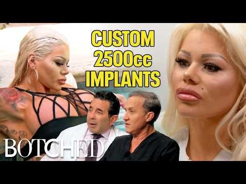 Candy's 2500cc Silicone Implants Make Her A Lot of Money | Rejected By Botched | E!