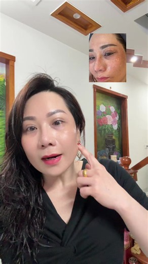 Chia sẻ kem vua nám cho chị em xem tham khảo xài trải nghiệm nè ok lắm nghen em linh xài cải thiện da mặt rồi nè