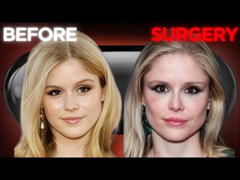 Why Surgery Doesn’t Always Make You Look Better