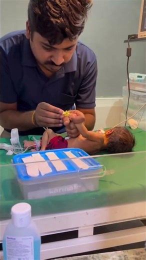 Iv cannula nicu baby #ojha #trending #newbornbaby