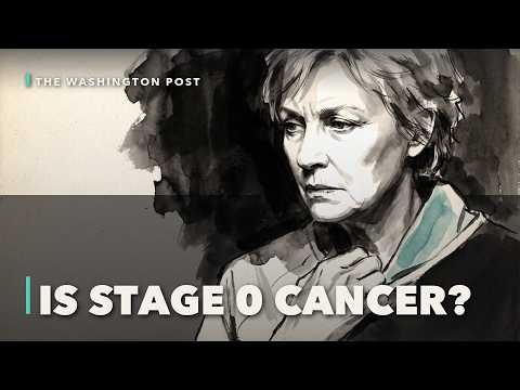DCIS, Stage 0 breast cancer: an oncologist on overtreatment