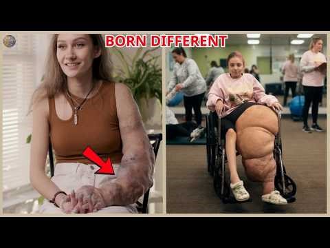 These 12 people will shock you – You won’t believe they actually exist – Rare People