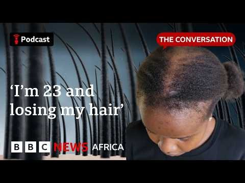 'Balding in my early twenties' | The Conversation | Focus on Africa