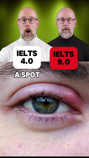 Do you know these skin words? a stye: A sore bump on the eyelid. a blister: A bubble of fluid on the skin. a callus: Thick, hard skin. a mole: A small dark spot on the skin. a birthmark: A mark you are born with. freckles: Small brown spots on the skin. a rash: Red or itchy skin. #learnenglish #ielts #ingles #angielski #ielts