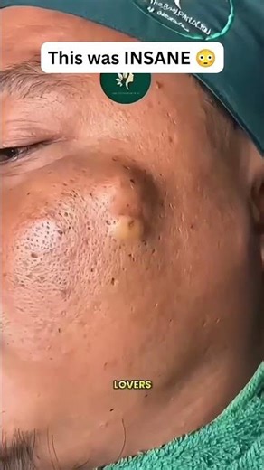 Pop Explosion! 🤯