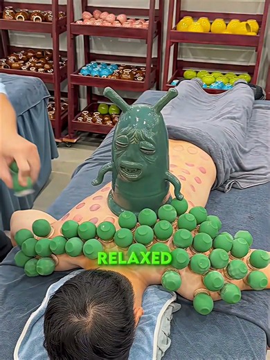 He Fell Asleep During a Cupping Session!