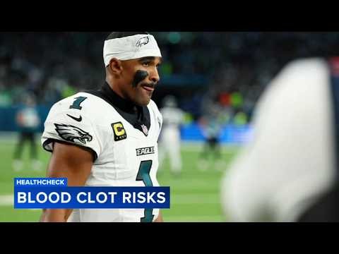 Jalen Hurts' diagnosis raises awareness of African American blood clot risk