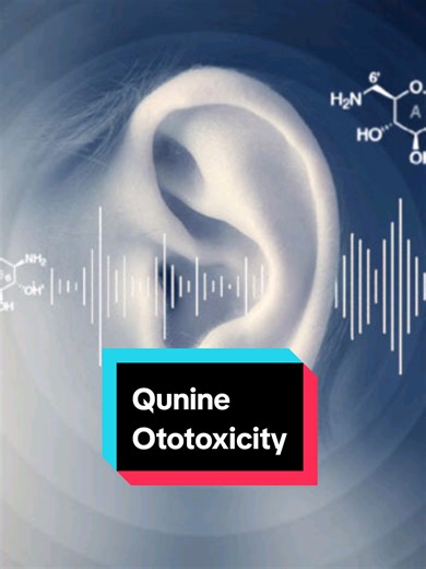 Quinine Ototoxicity የወባ በሽታ (Malaria) ለማከም የሚጠቅመው Quinine የመስማት ችግር ሊያመጡ ከሚችሉ (Ototoxic) መድሀኒቶች አንዱ ነው:: #habeshatiktok #የመስማትችግር #ethiopian_tik_tok🇪🇹🇪🇹🇪🇹🇪🇹 #ጆሮ #fyp