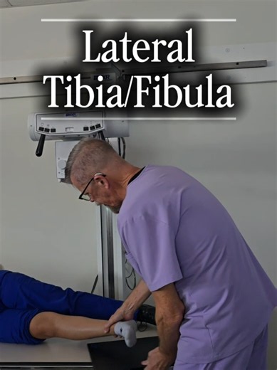 Next up, the lateral tib/fib! We're looking for both the knee and ankle joints, proper superimposition of the tibia and fibula, and no rotation. Another positioning demonstration with Mr. A! #xraytech #radtechstudent #radiology #chcp #lmrt