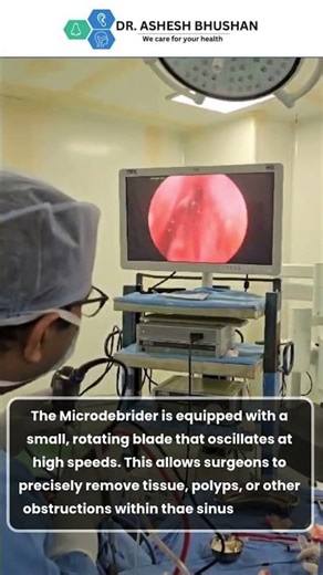 (Functional Endoscopic Sinus Surgery | Dr. Ashesh Bhusan