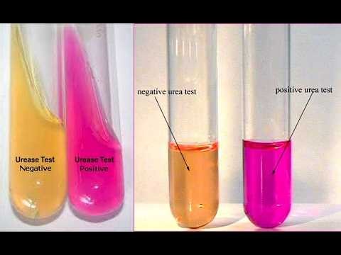 Urea Agar Christensen's Urea Agar ; Definition, Composition, Microbiology, Preparation, Uses