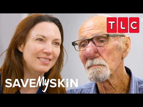 Shocking Face Transformations | Save My Skin | TLC