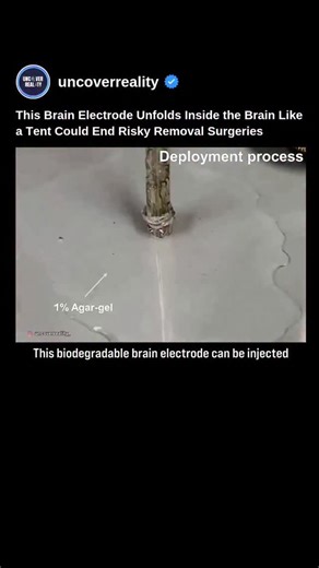 Uncover Reality | From Science to Space on Instagram: "Biodegradable Self-Deploying Brain Electrode: A New Era for Brain–Computer Interfaces Brain–computer interfaces (BCIs) could one day help restore movement, speech, and communication for people with neurological disorders. Current systems often require invasive brain surgery, which can carry risks like infections and inflammation. Researchers from Seoul National University, led by Jae-Young Bae, have developed a biodegradable, self-deploying 
