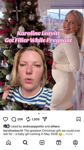 wtf. #popculture #botox #filler #popculturenews #karolineleavitt | pregnant lady