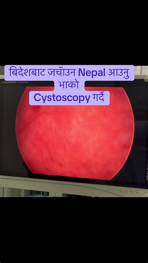 Nepal Cystoscopy Services: Your Health Matters