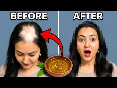 7 Days Hair Growth Challenge : Stop These 5 Mistakes Right Now & Your Hair Will Never Stop Growing