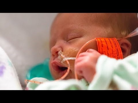 NG Tube Insertion in Neonate 👶 | Bronchiolitis Explained & Why NG Tube Is Needed 