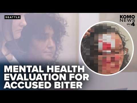 Seattle woman accused of biting off victim's forehead to undergo mental health evaluation
