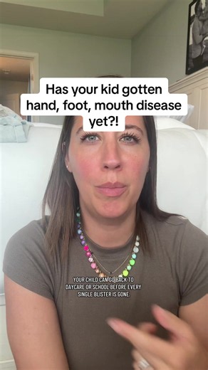 And bonus: HFMD is caused by several different viruses, so yes… unfortunately, your child can get it more than once. 😭 Save this for the next daycare outbreak. #hfmd #handfootandmouthdisease #pediatrics #parentingadvice #parentingguide