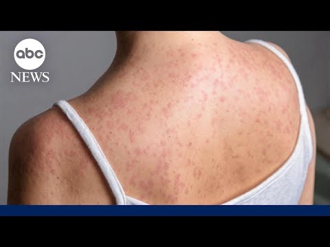 What to know about having a healthy heart