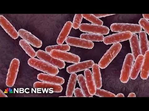 WHO seeks answers and clarity over plague lab death in Russia