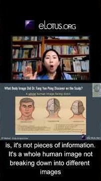 Read Your Body with Fang Scalp Acupuncture!