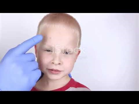 Progeria : old infants , A rare Genetic mutation.