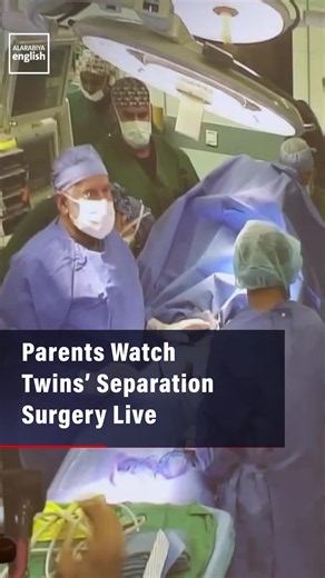 Fiji conjoined twins separation surgery in Saudi Arabia – 15-hour operation