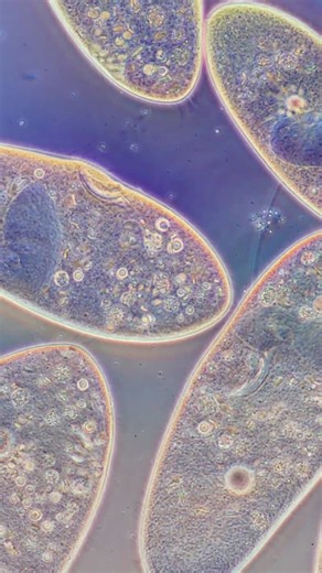 #biology #science #microbiology #protozoa #ciliate #optics #microscopy | Karl Gaff