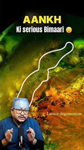 High Minus Power in Eye can Damage Retina #eyes #eyecare