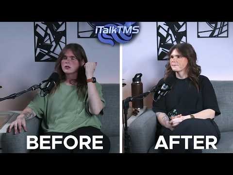 TMS therapy before and After - Lainey