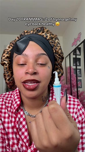 Day 2 y’all !!! #famousfr😘 #FRANNMAS | conjunctivitis eye