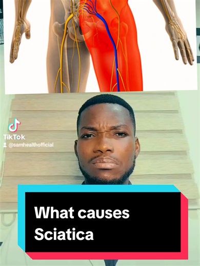 Understanding What Causes Sciatica Pain