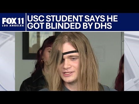 USC student hit in eye by DHS during 'No Kings' protest | FOX 11 LA