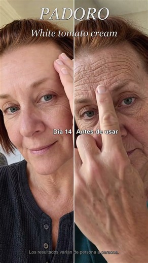 Fade your wrinkles,hide your real age #fyp #wrinkles #tiktokmadebuyit #antiwrinkle
