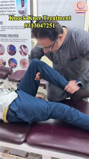 Knock Knee treatment | Dr. Varun Duggal Chiropractor | Chiropractic Treatment | Knee Pain