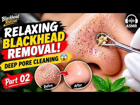 Relaxing Blackhead Removal & Deep Pore Cleaning ASMR | Satisfying Extraction! Part 02