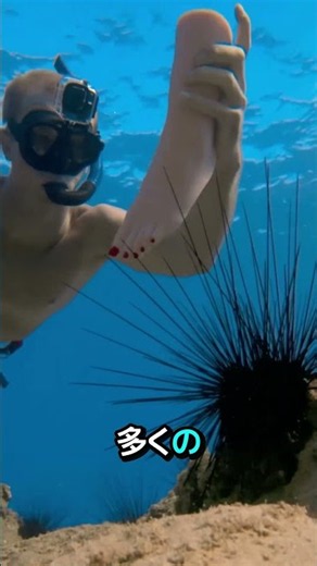 ウニを踏んだ時にやるべきこと