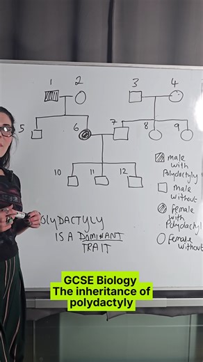 Understanding Polydactyly Inheritance in GCSE Biology