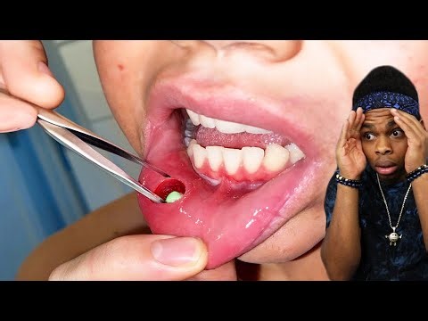 he thought it was just candy..