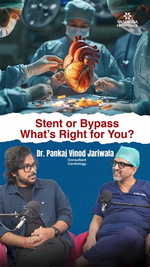 Choosing between a stent and bypass surgery is a common concern for heart patients. In this video, Dr. Pankaj Vinod Jariwala, Consultant Cardiologist at Yashoda Hospitals, explains how this decision is made - and it's not a coin toss! Dr. Jariwala reveals there's a systematic scoring system to determine the best treatment. If angioplasty can achieve results equivalent to bypass surgery without opening the chest, he recommends stenting. However, when bypass would deliver better outcomes, that bec