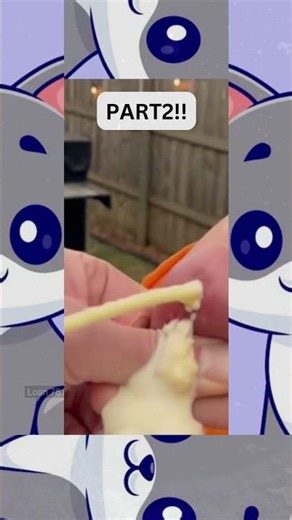 🔥Deep Blackheads, Milia & Whitehead Removal pimple popping New| Big Cystic Acne Extraction