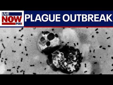 Suspected plague outbreak erupts in Russia after scientist dies