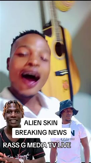 breaking News alien skin ali mubuzibu @SIR DR HUSEIN MWENE BUSOGA @MAMA TV UGANDA @fypシ゚viral @BukeddeTV