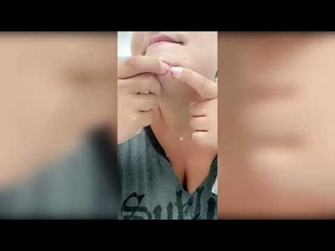 Best Pimple Popping Videos SATISFYING PIMPLE POPPING & BLACKHEAD REMOVAL COMPILATION #11